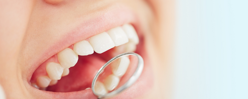 5 pasos para mantener tu salud dental